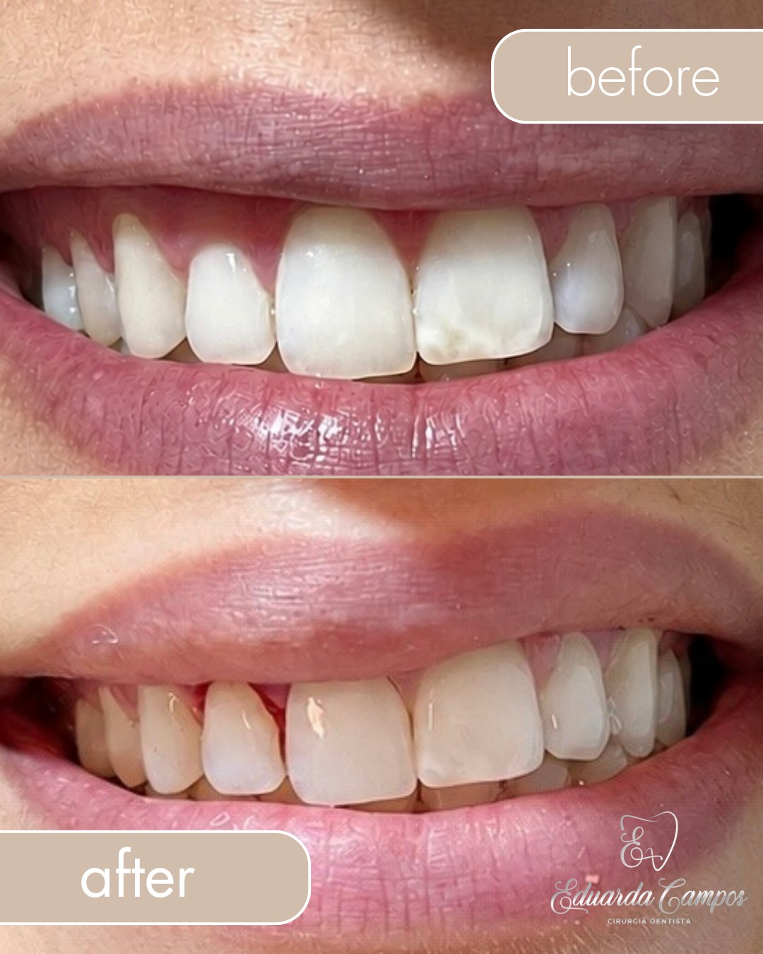 Resultado antes e depois de tratamento odontológico